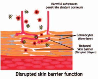 disrupted skin barrier function